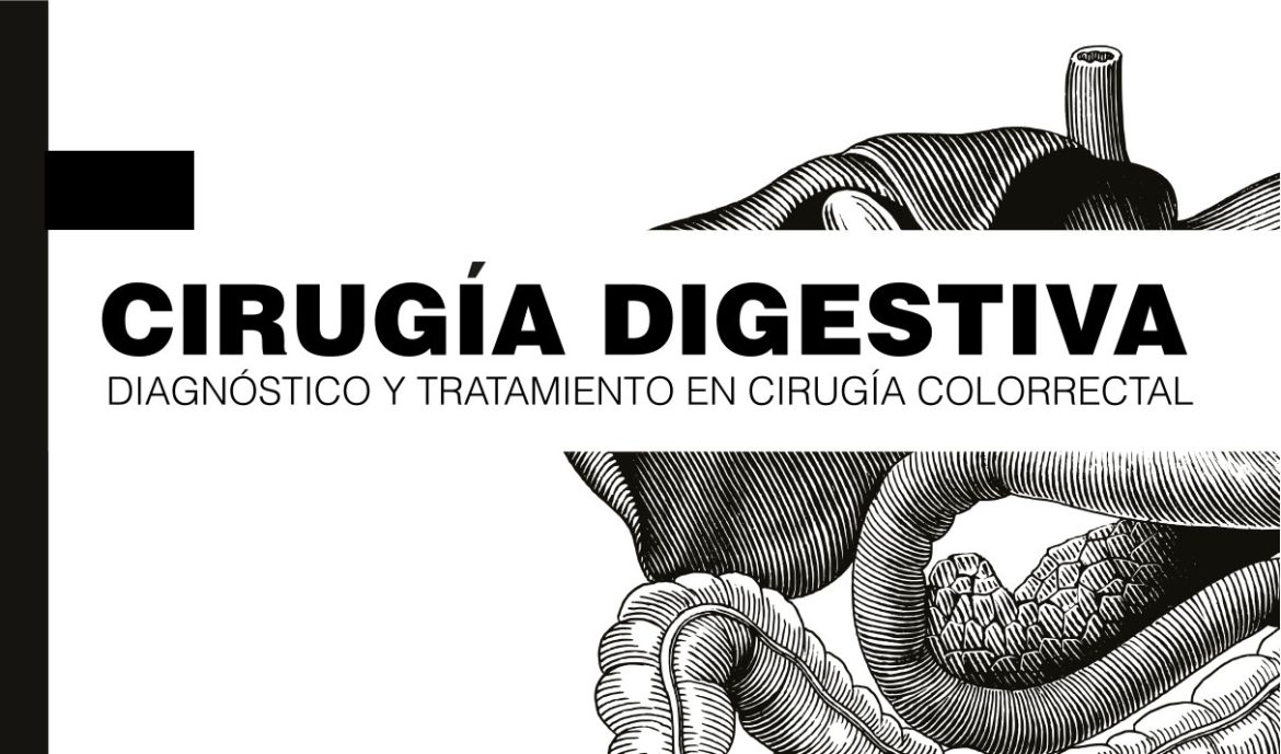 Cirugía Digestiva. Diagnóstico y tratamiento en cirugía colorrectal